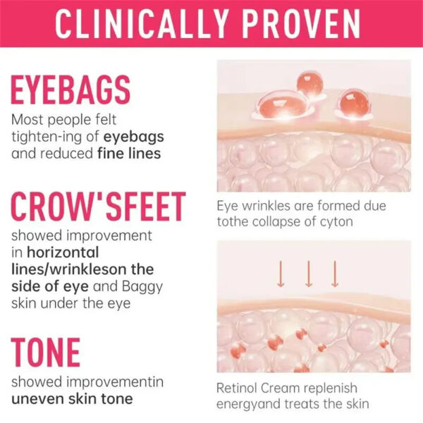 Instant Eye Bag Remove Cream Retinol Anti-Wrinkle Firming Skin Fade Fine Lines Anti Dark Circle Puffiness Brighten Eye S
