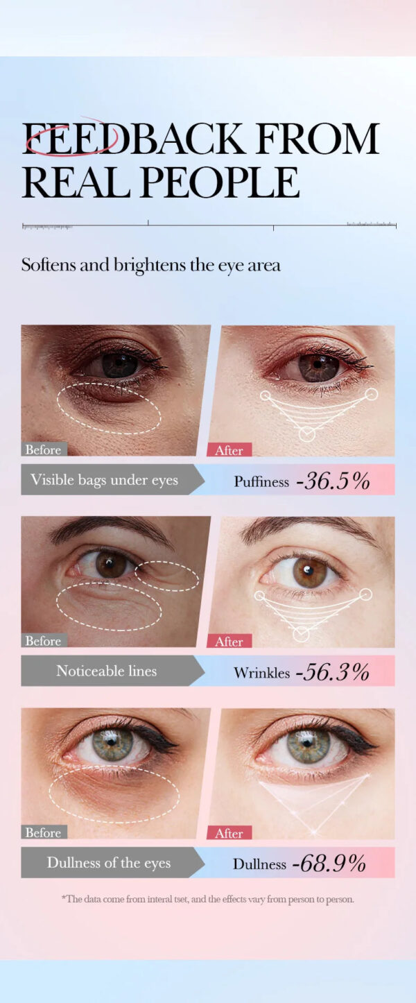 Instant Eye Bag Remove Cream Retinol Anti-Wrinkle Firming Skin Fade Fine Lines Anti Dark Circle Puffiness Brighten Eye S